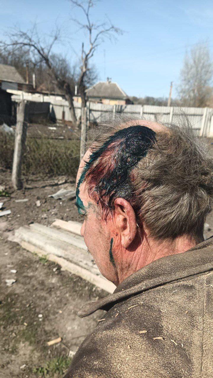 Житель Вовчанська після обстрілу