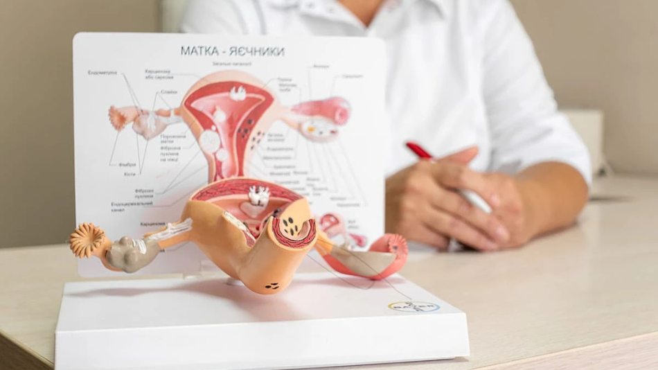 УЗД малого тазу допомагає виявити патологію